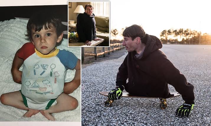 राउडी बर्टन (Rowdy Burton): इच्छाशक्ति का अनमोल उदाहरण