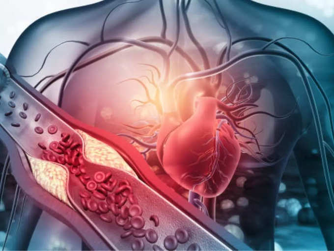 कोलेस्ट्रॉल कम करने के उपाय- Cholesterol Kam Karne Ke Upay