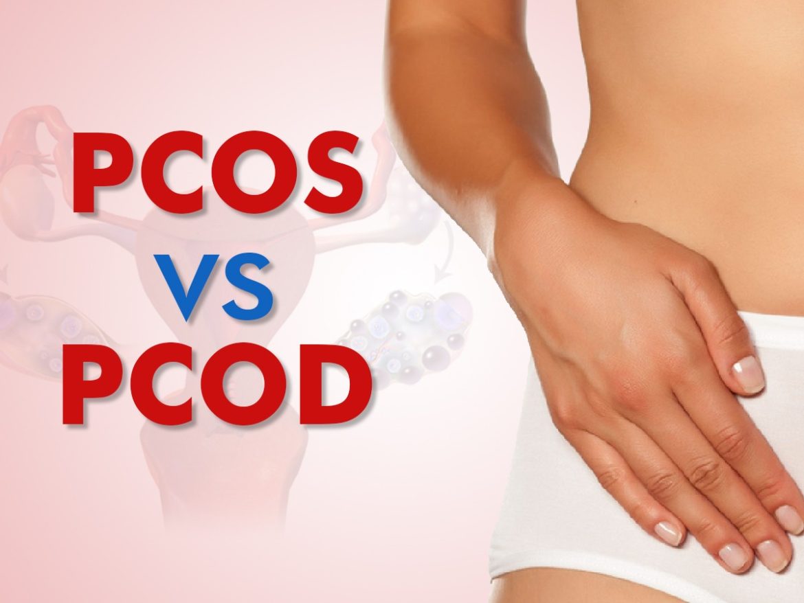PCOS Meaning in Hindi